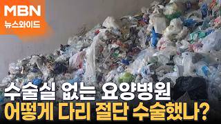 인천서 발견된 사람 다리, 어쩌다 마네킹으로 착각?…80대 환자로 추정 [뉴스와이드]