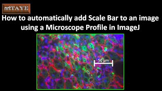Automatically add Scale Bar to an image using a Microscope Profile in ImageJ