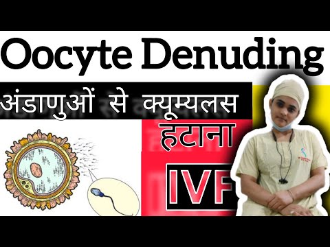 Oocyte Denuding prior to ICSI... Embryologist doing denuding of Oocytes for ICSI Ivf treatment