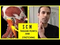 Dizziness, headaches, and neck pain from SCM trigger points