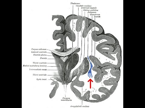 Why is the Claustrum So Spiritual?  Bruno Chikly, MD, DO.