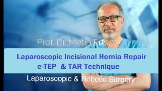 Miniaturka - Laparoscopic eTEP & TAR Repair. Metin Ertem MD.FACS