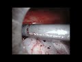 video thumbnail (7)