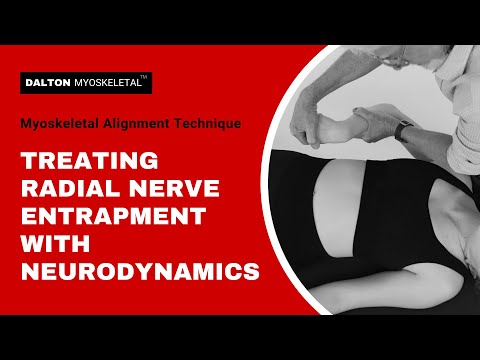 Free Yourself from Radial Nerve Entrapment with Neurodynamics! | ErikDalton.com