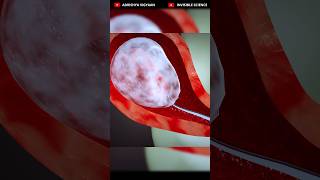 Understanding Abortion: 3D Animation Explaining D&amp;E Procedures | Dilation and Evacuation