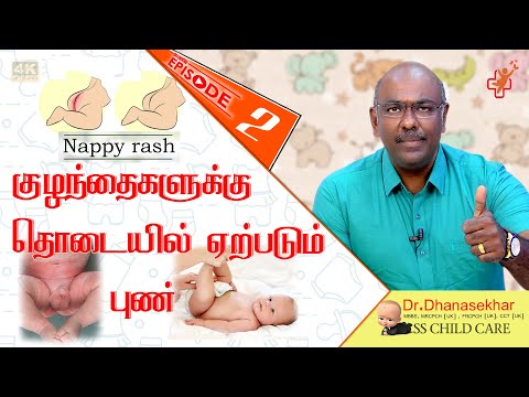 குழந்தைகளுக்கு தொடையில் ஏற்படும் புண் | Nappy rash in babies problem | Dr. Dhanasekhar Kesavelu Video