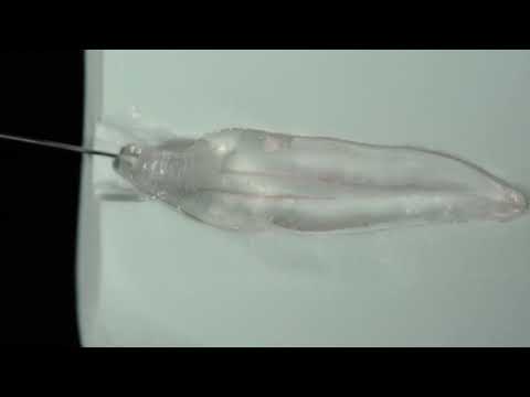 Endodontic coronal preparation: Gates