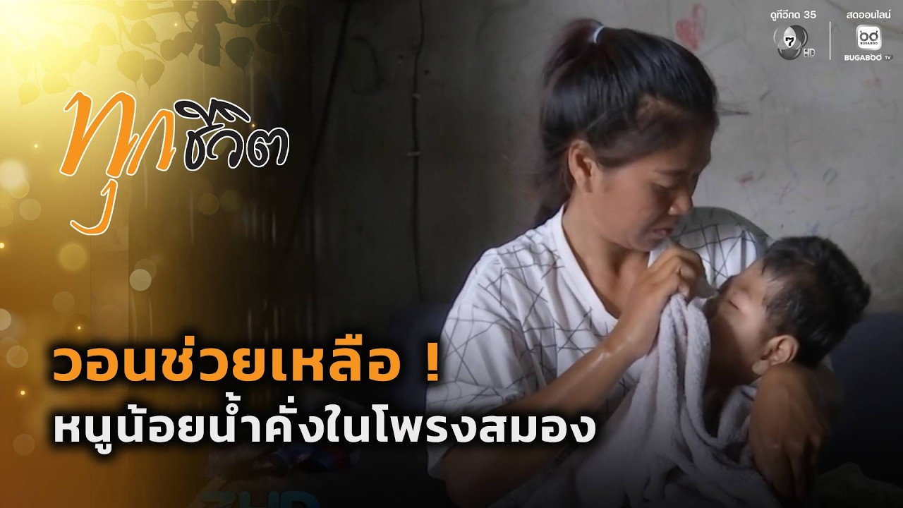 วอนช่วย ! หนูน้อยน้ำคั่งในโพรงสมอง | ทุกชีวิต