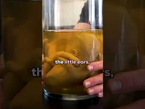 The Smallest Donated Body in Our Lab