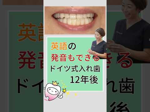 英語の発音もできるドイツ式入れ歯(テレスコープ義歯) 12年後
