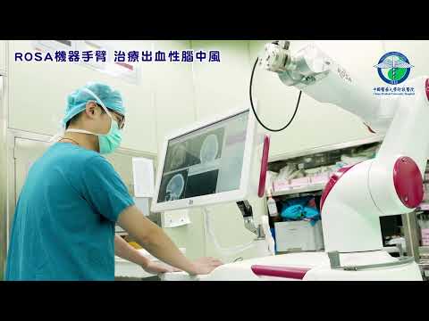ROSA機器手臂治療出血性腦中風