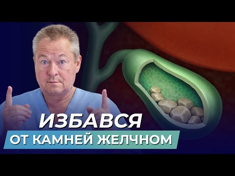 Как удалить камни в желчном пузыре без операции