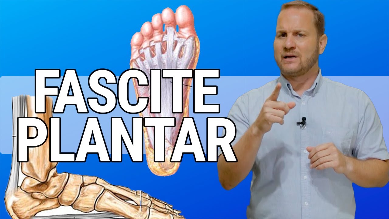 FASCITE PLANTAR