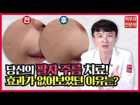 팔자 주름이라고 다 같은 팔자 주름이 아닙니다. 팔자 주름의 원인과 치료법!