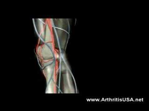 What are the Most common Causes of Knee pain?