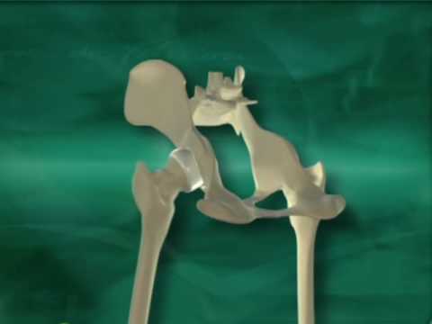 Behandlung von degenerativen Bandscheibenerkrankungen der lumbalen Massage Ps das rechte Kniegelenk ist