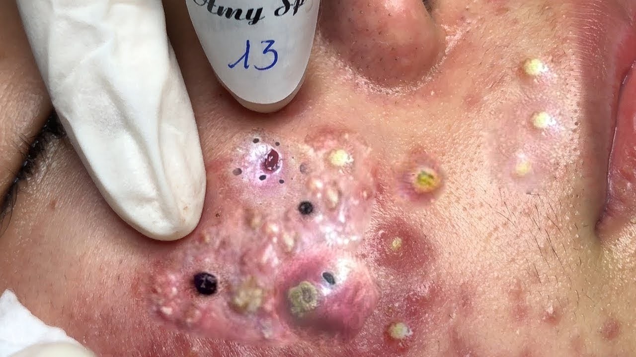 𝑺𝒐𝒐𝒕𝒉𝒊𝒏𝒈 𝑭𝒂𝒄𝒊𝒂𝒍 𝑻𝒓𝒆𝒂𝒕𝒎𝒆𝒏𝒕 𝑭𝒐𝒓 𝑺𝒕𝒓𝒆𝒔𝒔 𝑹𝒆𝒍𝒊𝒆𝒇 𝒂𝒕 𝑳𝒖𝒙𝒖𝒓𝒚 𝑺𝒑𝒂 𝑨𝒄𝒉𝒊𝒆𝒗𝒆 𝑰𝒏𝒏𝒆𝒓 𝑷𝒆𝒂𝒄𝒆 #887989