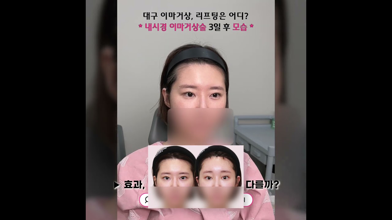 이마거상 KEY를 찾아오는 이유, 3일후모습