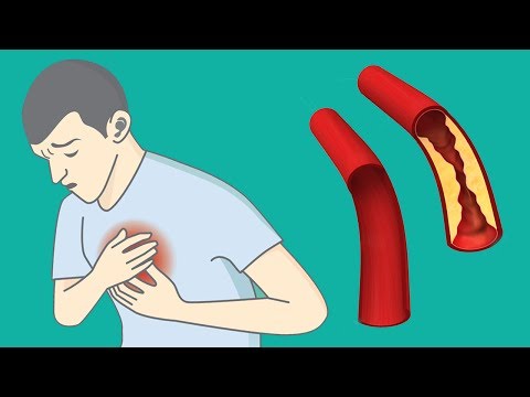 Und Prostata-Massage Präoperative Prostata