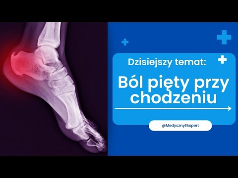 Ból pięty przy chodzeniu - przyczyny i leczenie