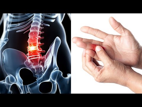 Schüsse Prostatitis prostakor Bewertungen Prostamol mit Schwierigkeiten beim Urinieren
