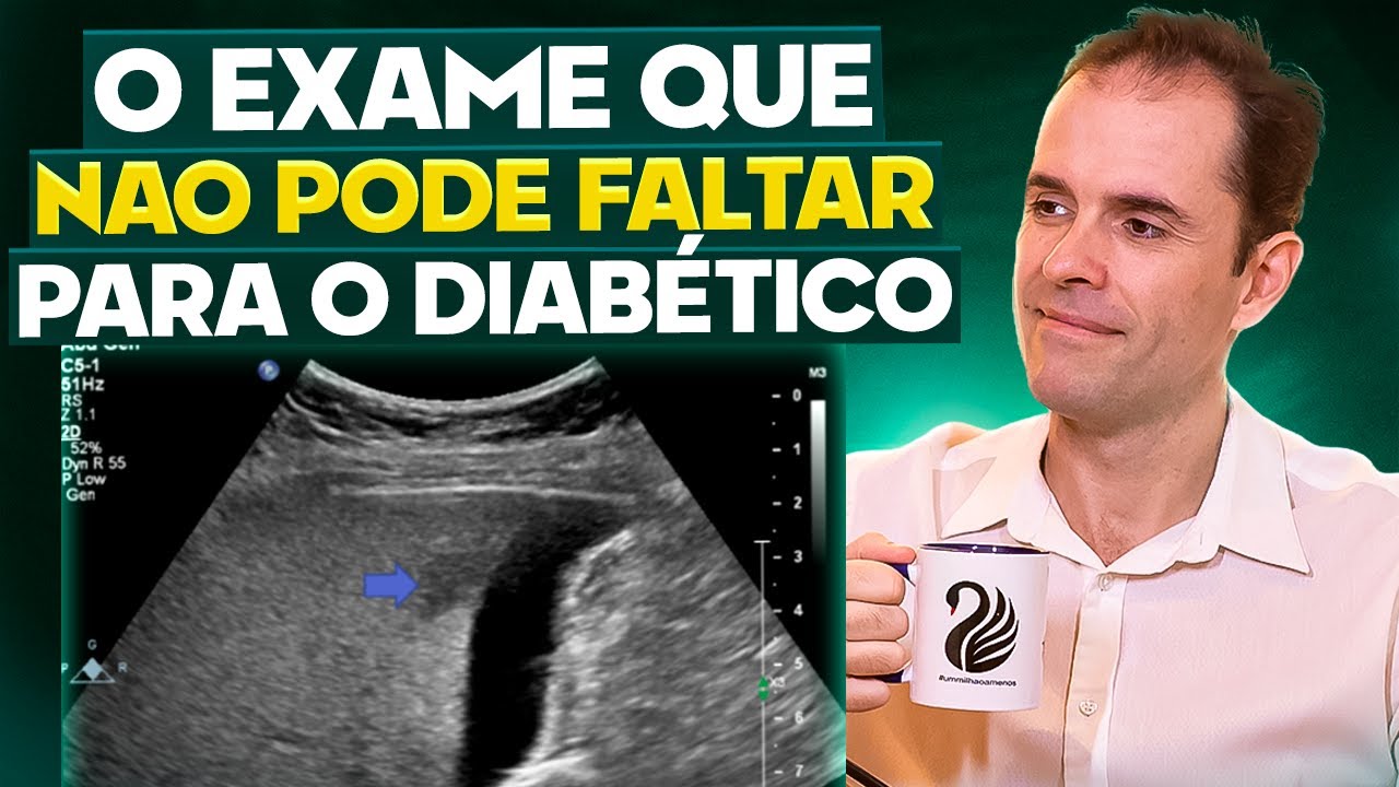 O EXAME QUE NÃO PODE FALTAR PARA O DIABÉTICO