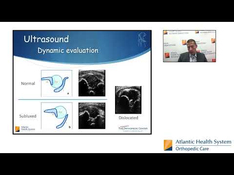 Developmental Dysplasia of the Hip