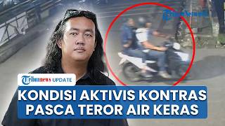 Update Keadaan Aktivis KontraS Andrie Yunus Pasca Teror Air Keras, Mata Kanan Komplikasi Serius