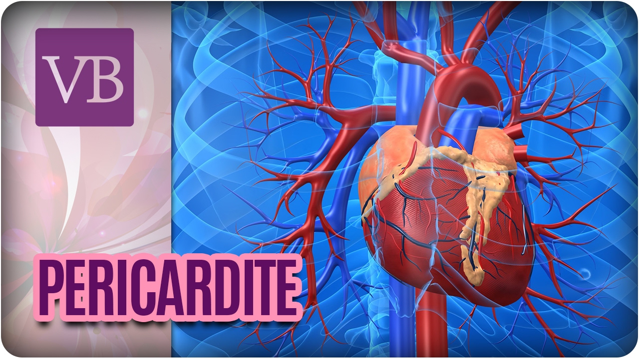 Pericardite: Inflamação do Pericárdio - Você Bonita (21/02/17)