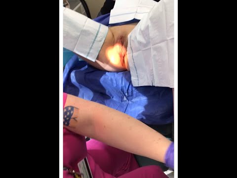 Video from Dr. Katz's YouTube channel