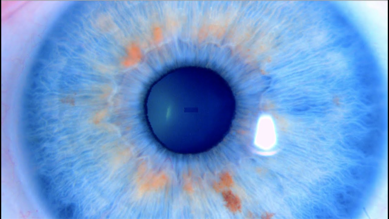 ¿Pertenecen a la misma familia todas las personas de ojos azules