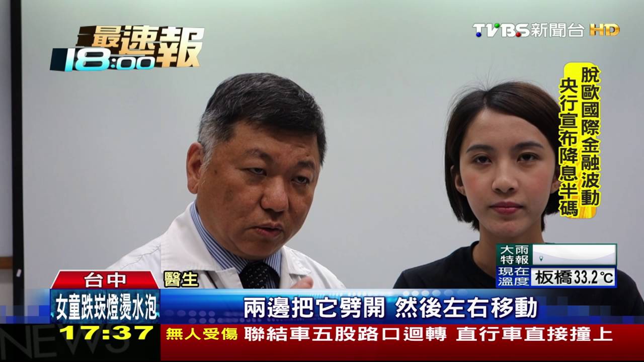 3D列印整形救戽斗 7年花70萬變正妹
