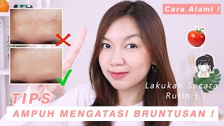 Download lagu Cara Mengatasi Bruntusan Secara Alami ala Desty || Desty Yufenti mp3