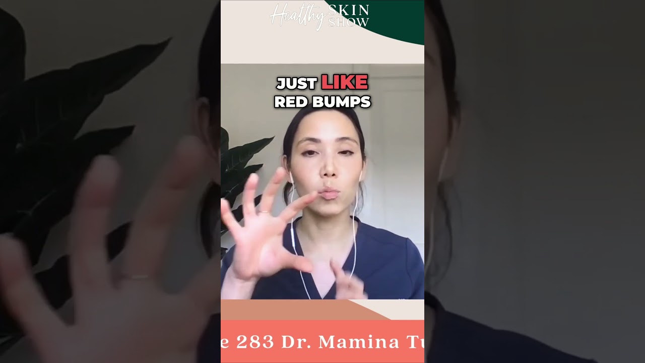 Shocking Shingles SYMPTOMS 😳 #shorts