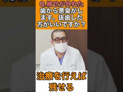 被せ物が外れた歯から悪臭がする！抜歯しないととんでもない事に。。。？#Shorts