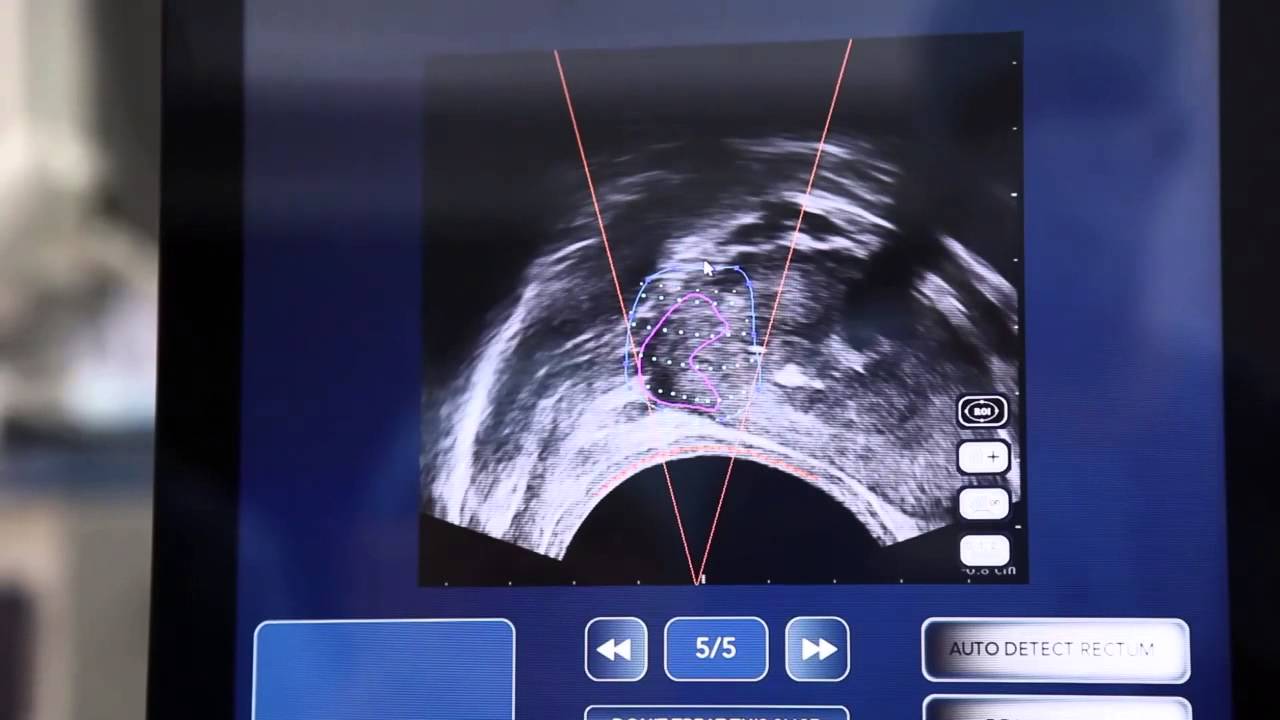 Krzysztof Rożnowski-10