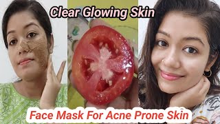 Get Spotless Glow & Remove Pimple Scars Naturally At Home || Krrish Sarkar