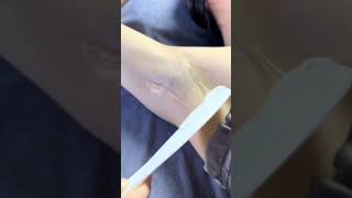 Hair Removal in Poipet