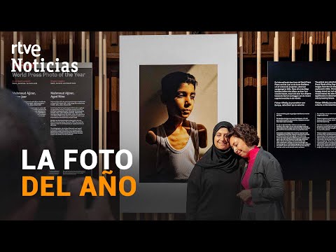 Fotografía de un niño gazatí mutilado por bombardeos israelíes gana el World Press Photo 2025