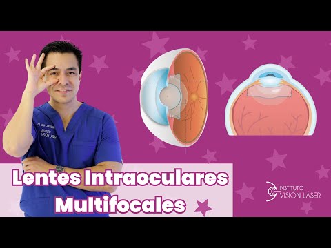 Lentes intraoculares multifocales