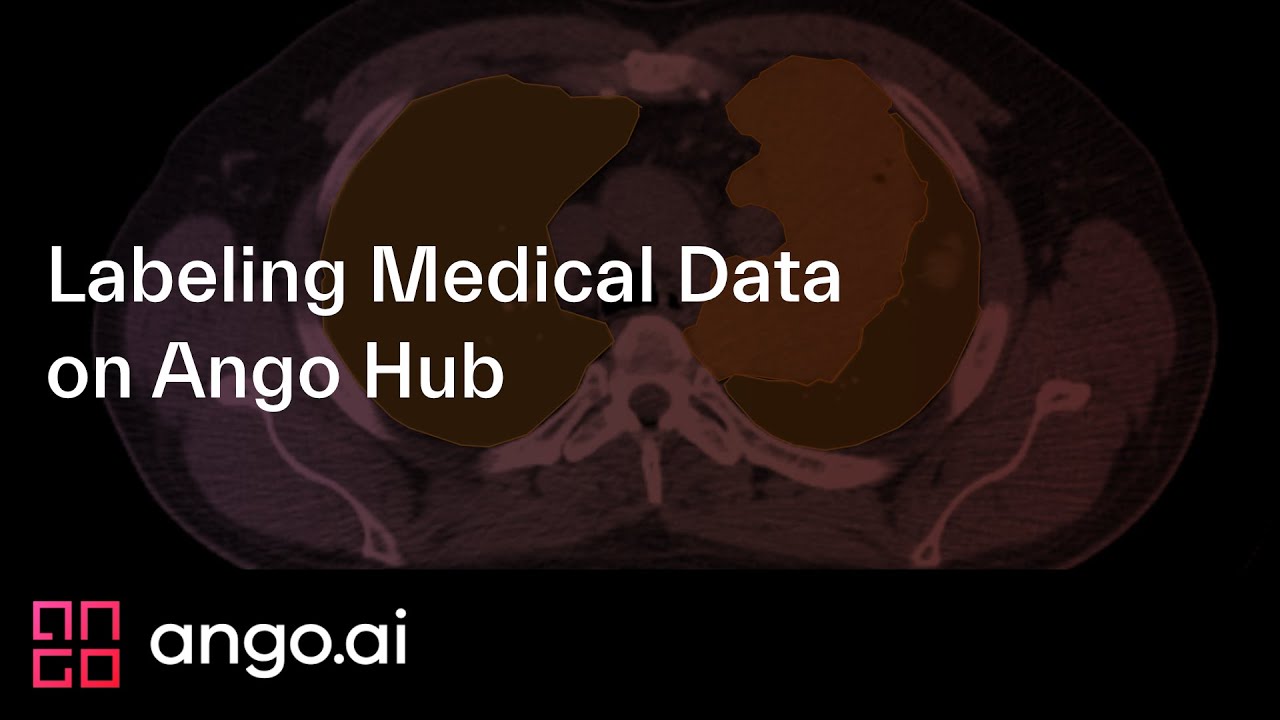 Labeling Medical Data on Ango Hub - Walkthrough
