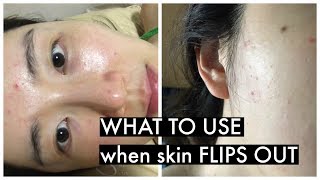 Whiteheads, Zits, Inflammation Emergency &amp; Hacks! #productsthatwork