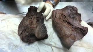 Dr.Ahmed Elzainy heart&lung  (practical)