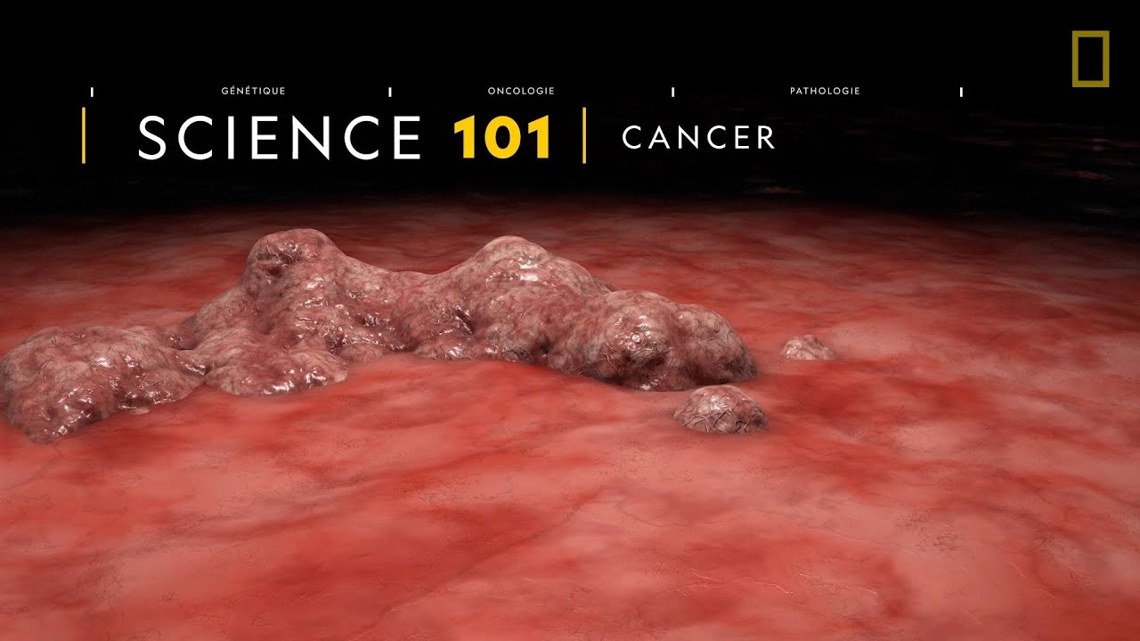 COMPRENDRE : le cancer