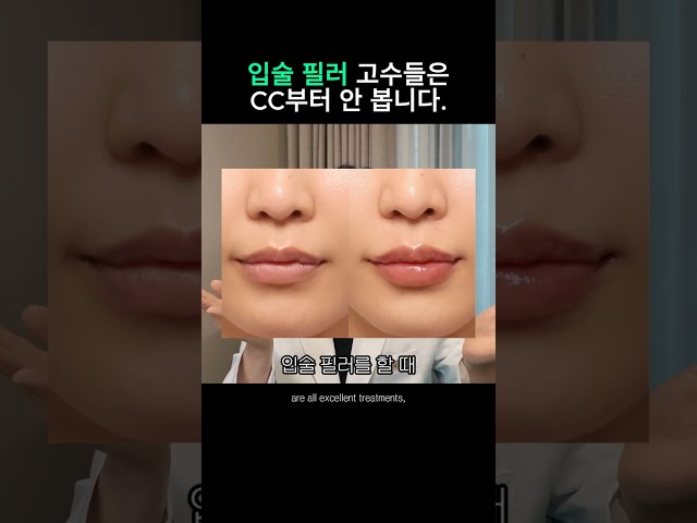 입술필러 고수들은 cc부터 안봅니다.