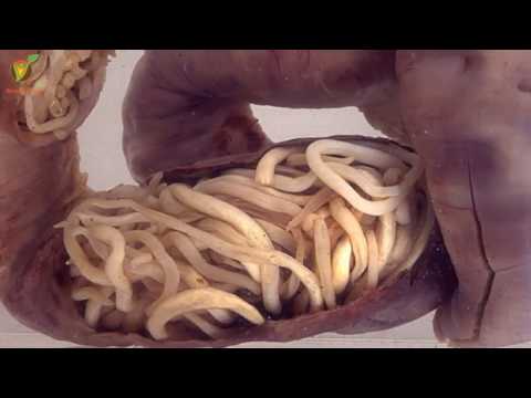 Semne de pinworm și tratament