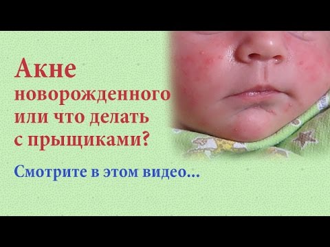 Красивое плетение кос на средние волосы самой себе, девочке Коса: наизнанку, вывернутая, на выворот, наоборот - как плести?