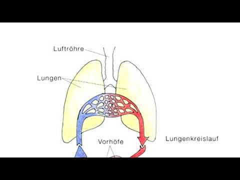 Arterielle Hypertonie, Rheuma Salz für hypertensive
