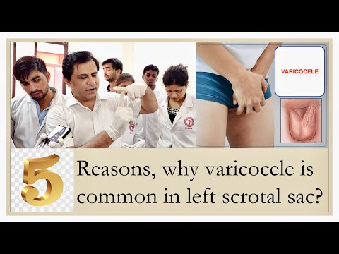 Varicocele | Five Reasons, Why varicocele is more common on left side? Left testicular vein