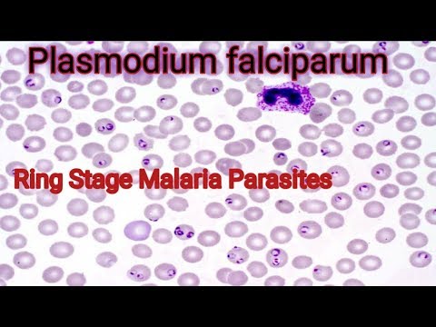 Ig E (felnőtt) Immunoglobulin e paraziták